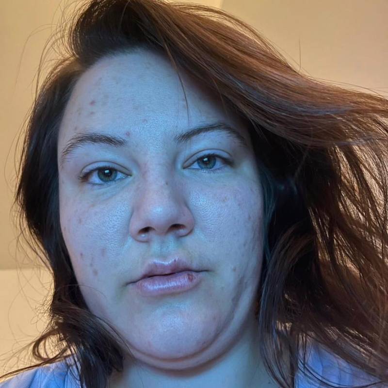 Melissa echo, 40, Murtajapur