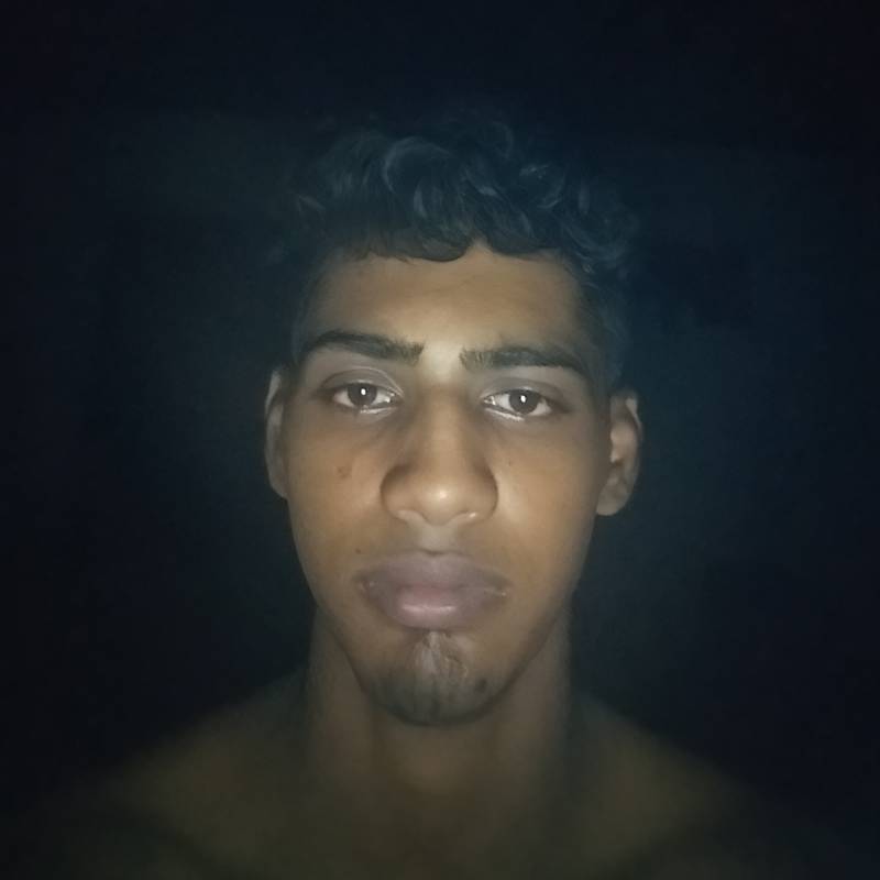 Simman, 18, Kusmaul
